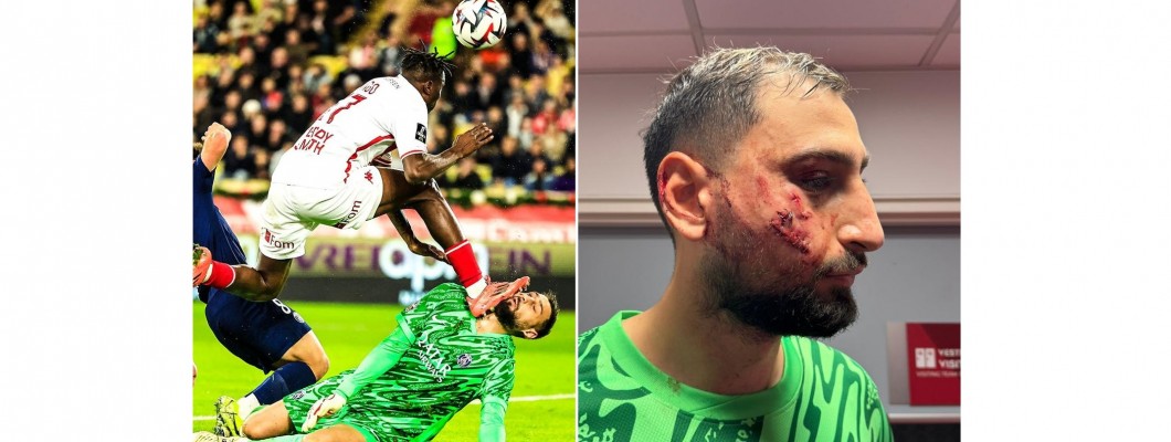 Krvavý! Donnarumma byl zraněn a měl na obličeji 10 stehů