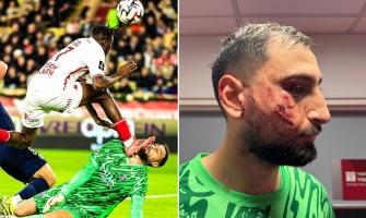 Krvavý! Donnarumma byl zraněn a měl na obličeji 10 stehů